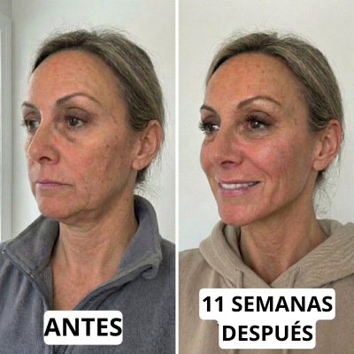 Redefine el contorno de tu rostro desde casa