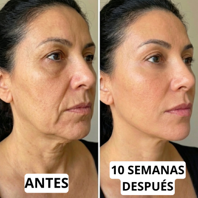 Redefine el contorno de tu rostro desde casa